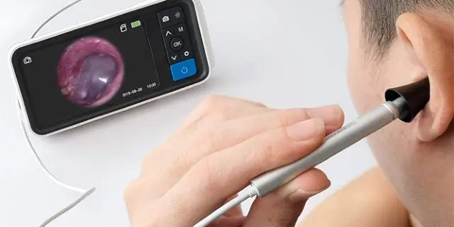 Top 5 Earwax Removers for 2026 AUS – Ava's Review